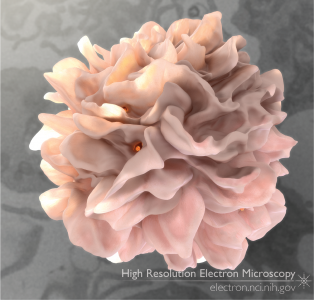 Dendritic Cell with HIV