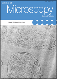 Journal of Microscopy, October 2004